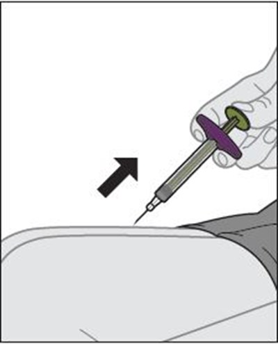 zymfentra-24.jpg Figure K - zymfentra 24