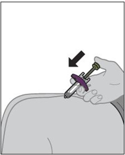 zymfentra-35.jpg Figure J - zymfentra 35