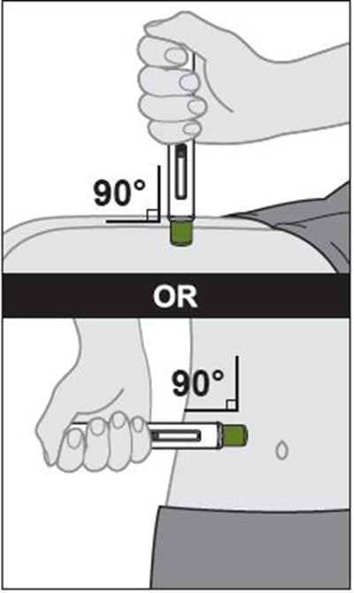 zymfentra-9.jpg Figure I - zymfentra 9