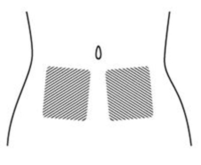 Figure F (Icatibant 08)