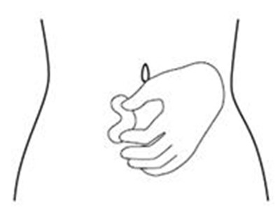 Figure G (Icatibant 09)