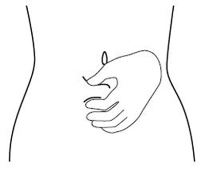 Figure J (Icatibant 12)