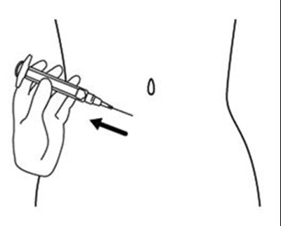 Figure N (Icatibant 16)