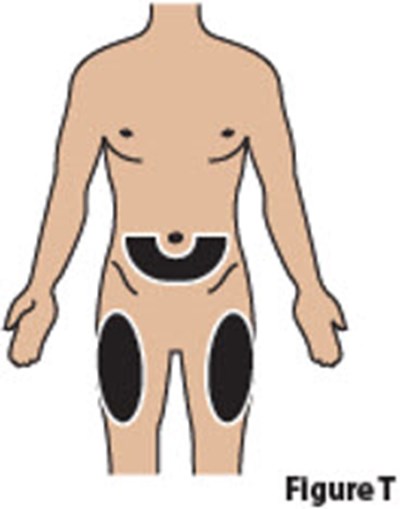 Figure T (Besremi 19)