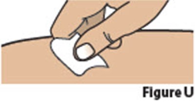Figure U (Besremi 20)