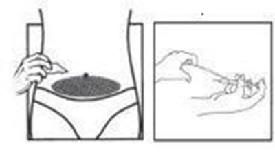Figure (Cetrorelix 11)