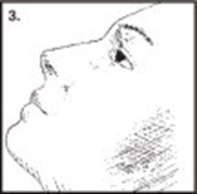 Figure 3 - cro03 0000 04