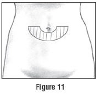 Figure 11 (Follistim Aq Cartridge 14)