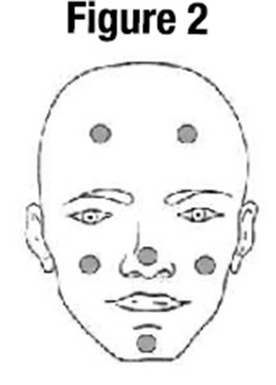 Fig-2 (Fig 2)