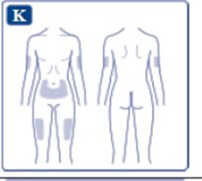 Step 4 (Fig. K)