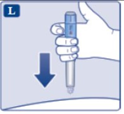 Step 4 (Fig. L)