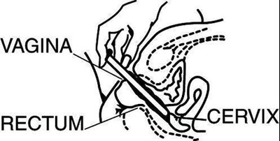 Figure2 (Figure2)