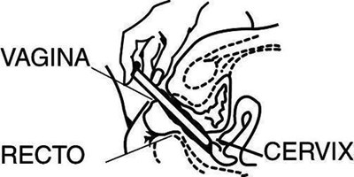 Figure4 (Figure4)