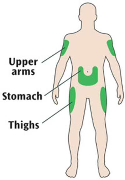 Image - insulin glargine 26