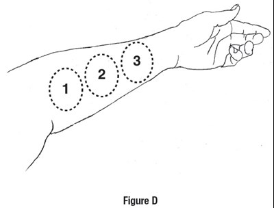 Figure D (Image 12)