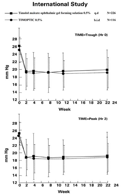 timolo-gfs-figure-2 - timolol gfs figure 2