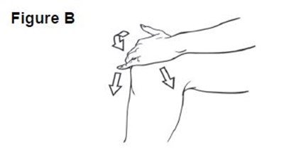 Figure B (Figureb)