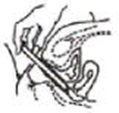 Figure (Terconazole Crm 8 04)