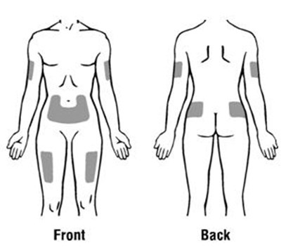 Figure 11 - procrit 11