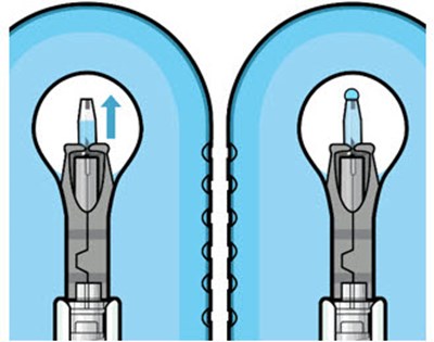 Figure 10 (Susvimo 10)