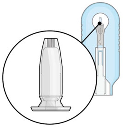 Figure 2 (Susvimo 33)