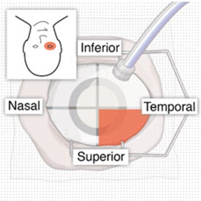 Figure 10 (Susvimo 44)