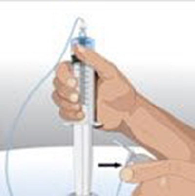 image-11.jpg If using a syringe driver pump, attach the syringe filled with GAMMAGARD LIQUID to the needle set. On a hard surface, gently push down on the plunger to fill (prime) the pump tubing up to the needle hub. This will ensure that no air is left in the tubing and needle . - image 11
