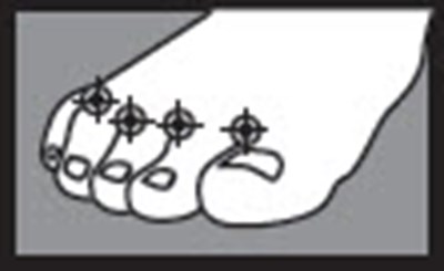 Figure 1 - antifungal 01