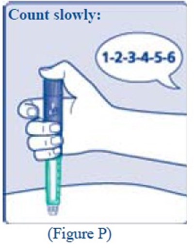 Step 13 Fig P.jpg (Aa947266 E27c 432b 8e04 C36168d24ddb 42)