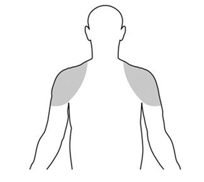 Figure A (Testim 1)