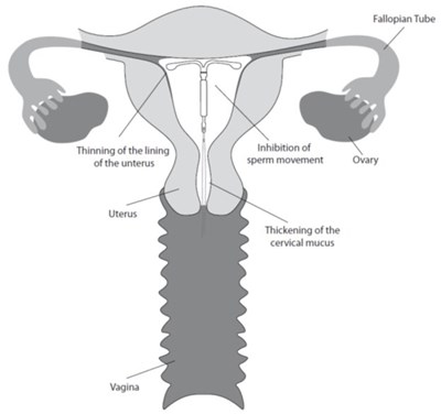 Uterus (Image 05)