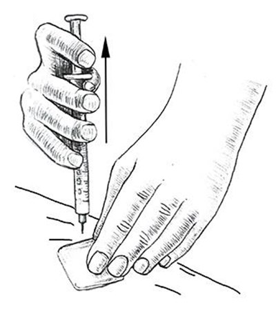 Leuprolide-fig-12 (Leuprolide Fig 12)