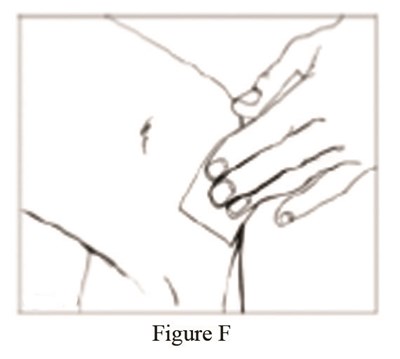 Figure F (Diclofenac Sodium Topical Gel 1 Percent Rx 7)