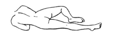 Patient Image 3a (Image 04)
