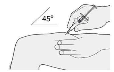 Figure I - wezlana 33