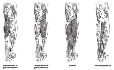 Figure 5 (Botox 06)