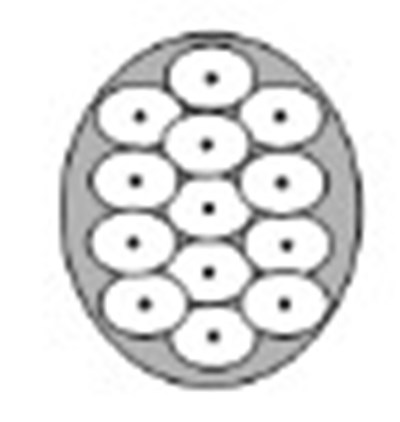 Figure 6: Injection Pattern For Primary Axillary Hyperhidrosis (Botox 07)