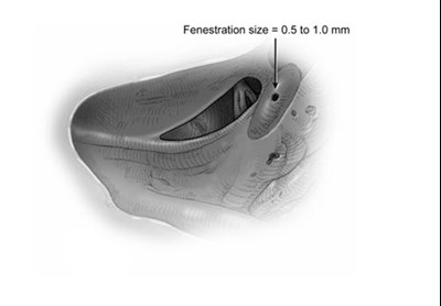 Figure 2 (Otarmeni 03)