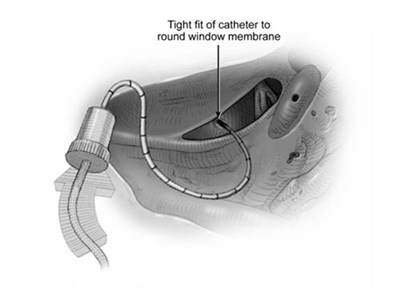 Figure 3 (Otarmeni 04)