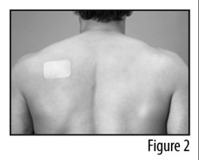 Figure 2 (Patch applied to back)