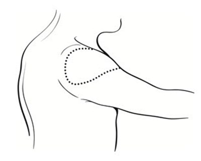 Figure (Bcg Vaccine 02)
