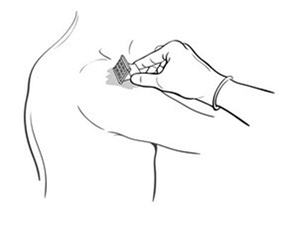 Figure (Bcg Vaccine 04)