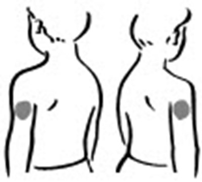Figure (Increlex 09)