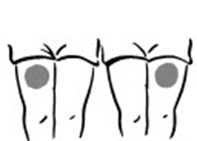 Figure (Increlex 10)