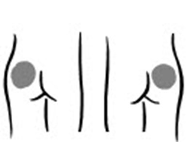 Figure (Increlex 11)