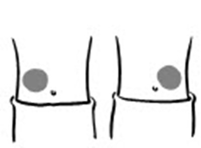 Figure (Increlex 12)