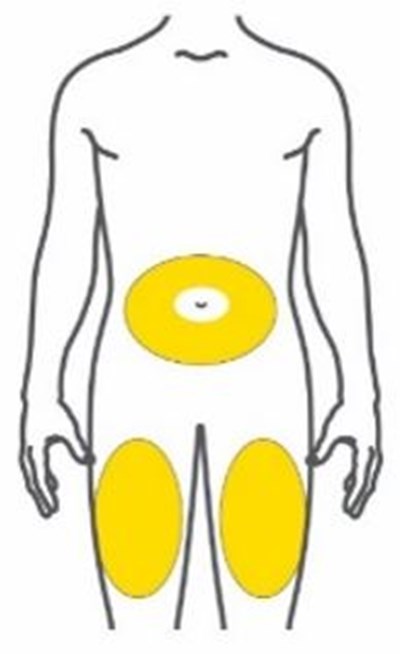 Figure (Trulicity Ifu 0point75 Injection Sites Front V1)