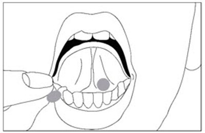 Image - buprenorphine 02