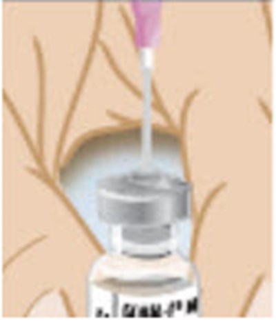 gonal-08.jpg PRINCIPAL DISPLAY PANEL -  - 75 IU Vial Label - gonal 08