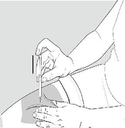 Figure G (Image 10)